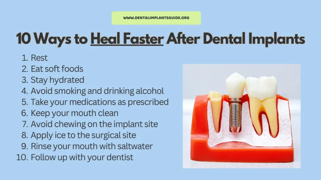 10 Ways to Heal Faster After Dental Implants