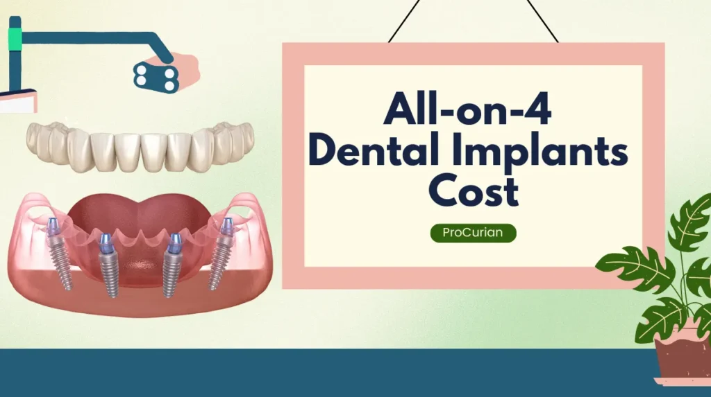 All-on-4 Dental Implants Cost