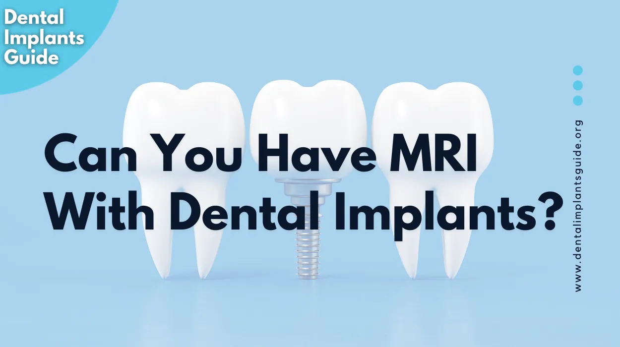Can You Have MRI With Dental Implants