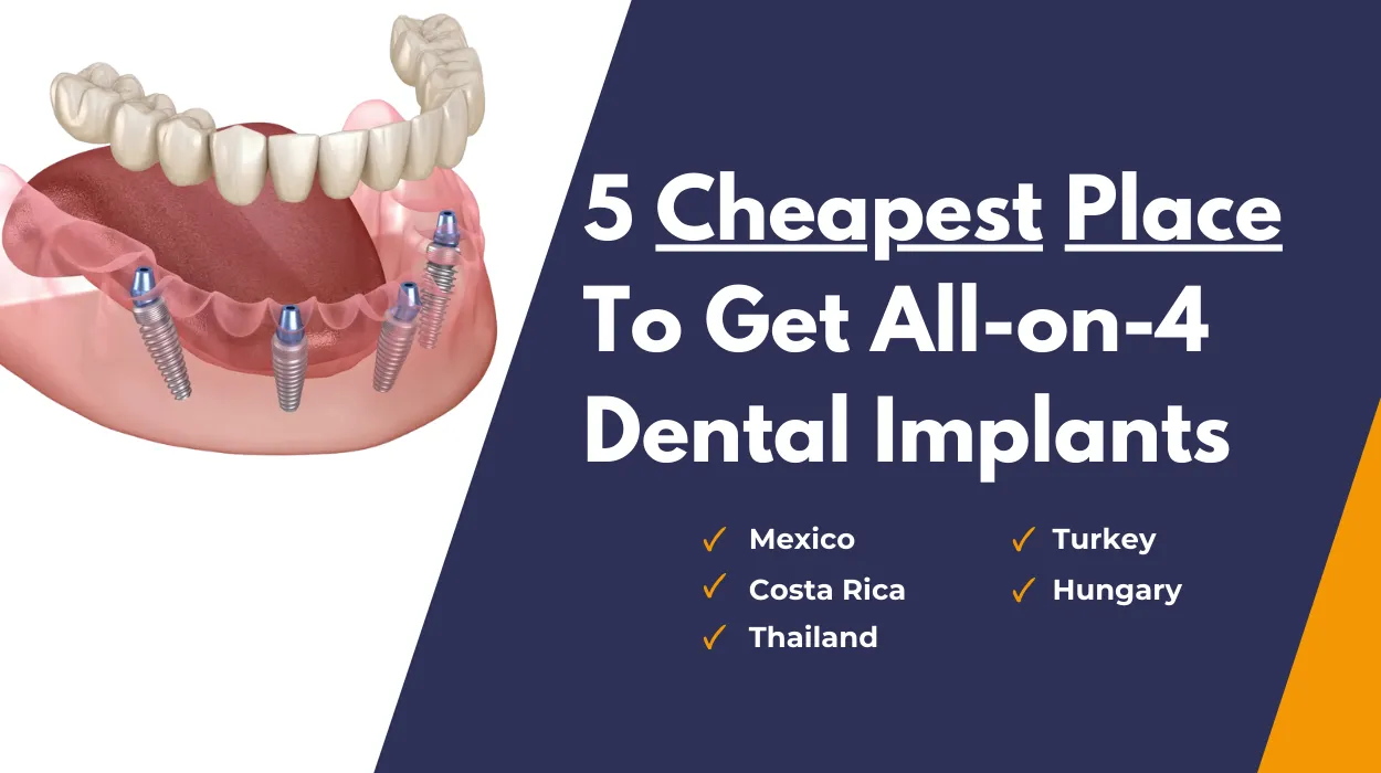 Cheapest Place To Get All-on-4 Dental Implants