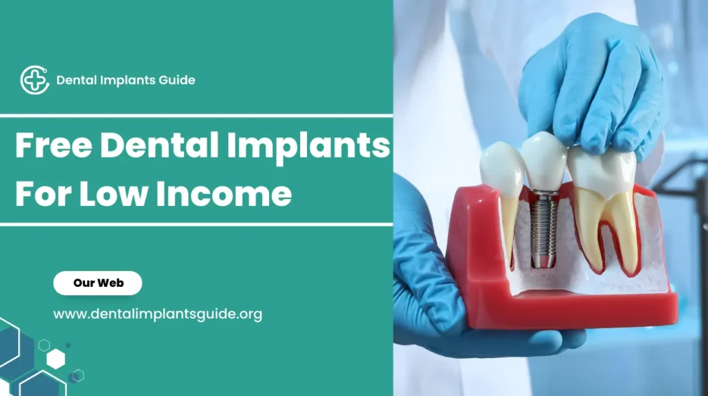 Free Dental Implants For Low Income
