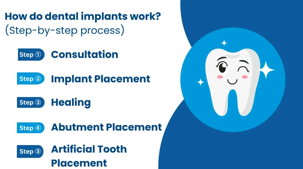 How do dental implants work