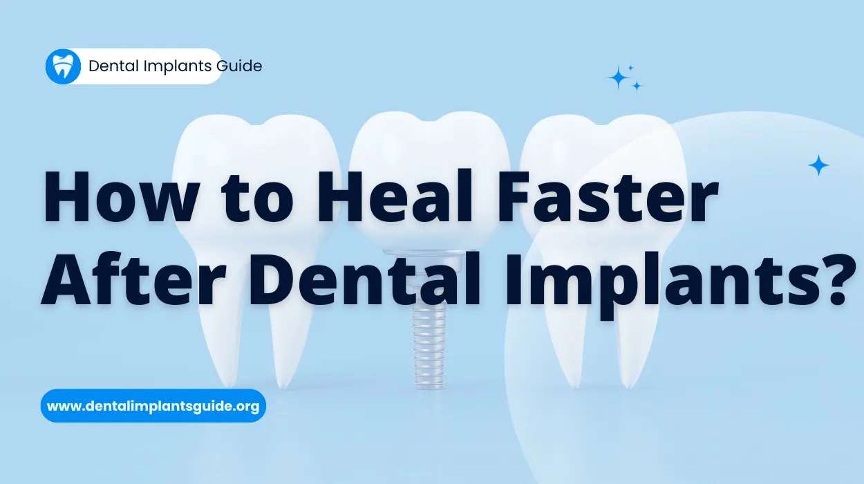 How to Heal Faster After Dental Implants