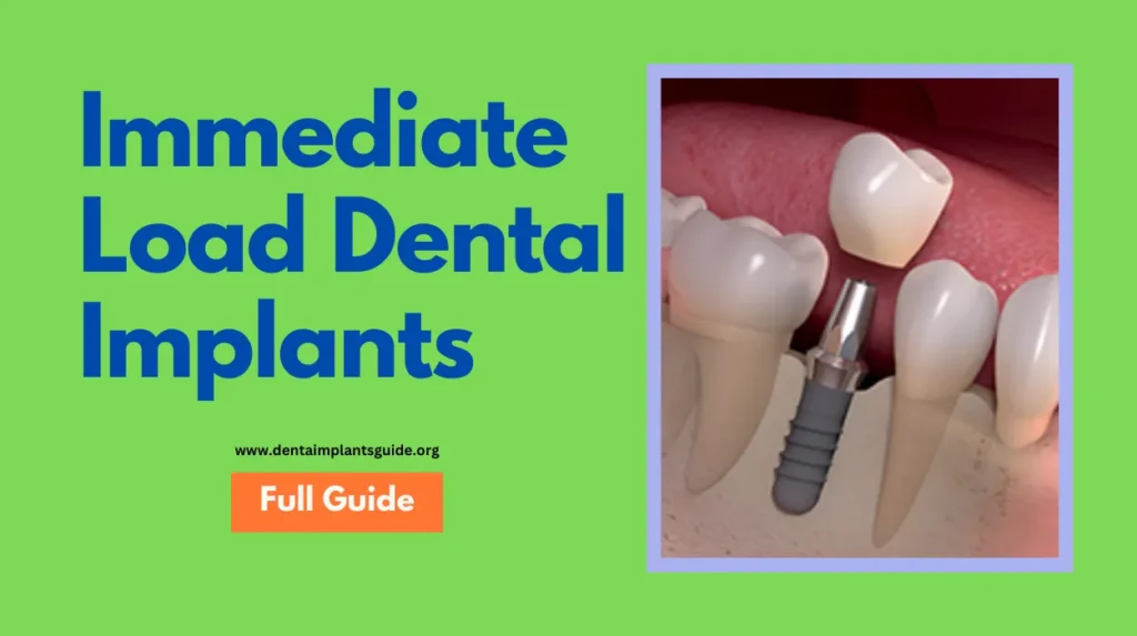 Immediate Load Dental Implants