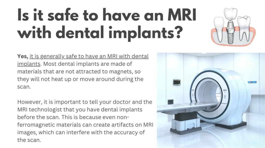Is it safe to have an MRI with dental implants