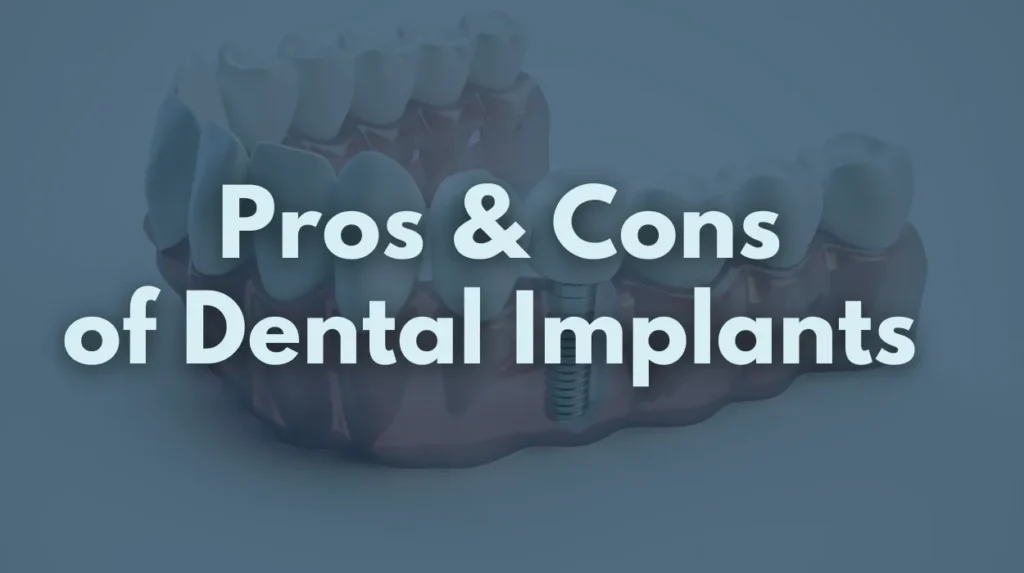 Pros and Cons of Dental Implants