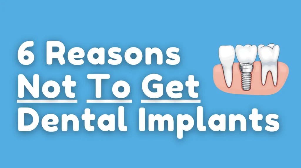 Reasons Not To Get Dental Implants