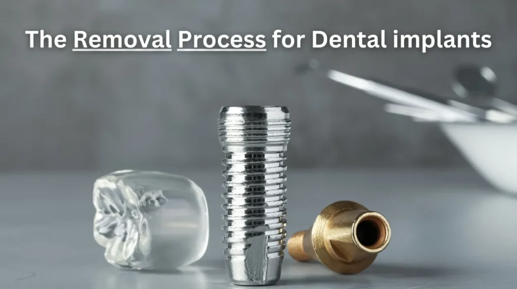 The Removal Process for Dental implants