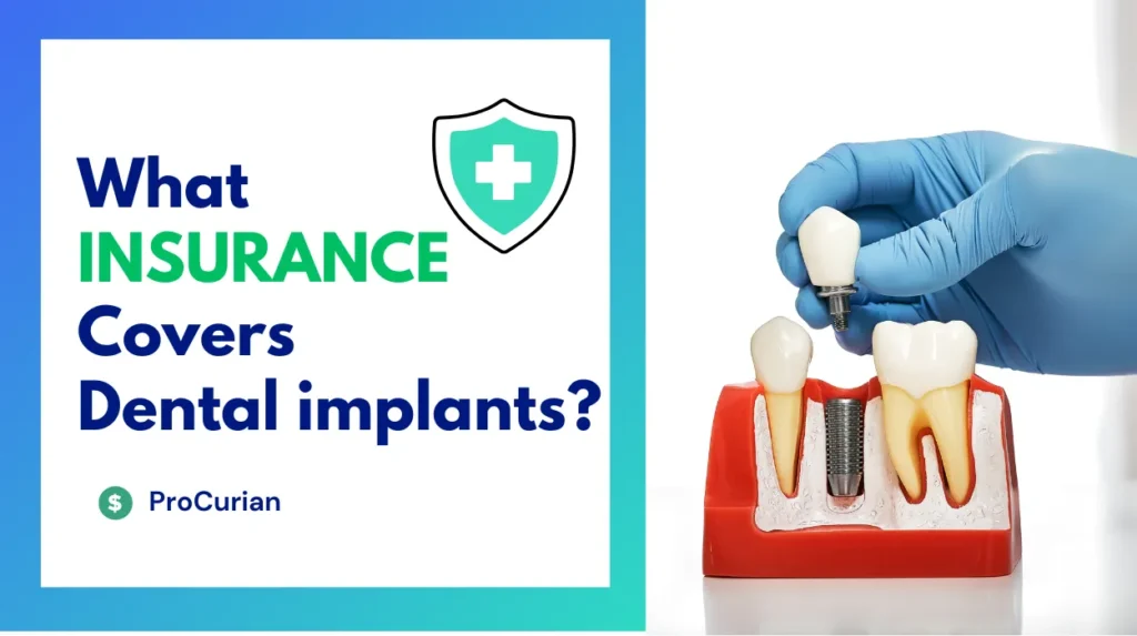 What INSURANCE Covers Dental implants