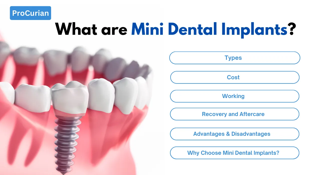 What are Mini Dental Implants