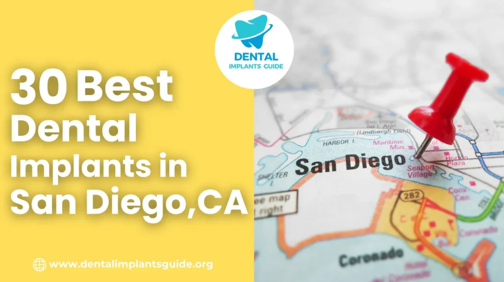 Dental Implants in San Diego