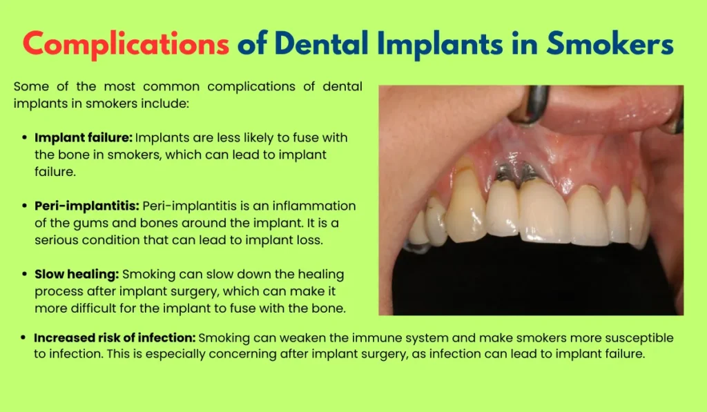 Complications of Dental Implants in Smokers
