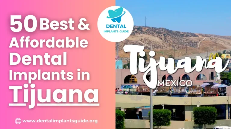 dental implants in Tijuana