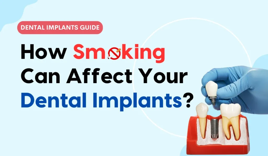 How Smoking Can Affect Your Dental Implants