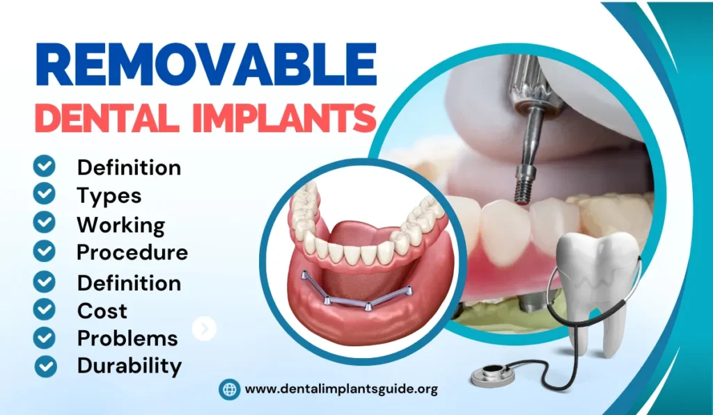 Removable Dental Implants