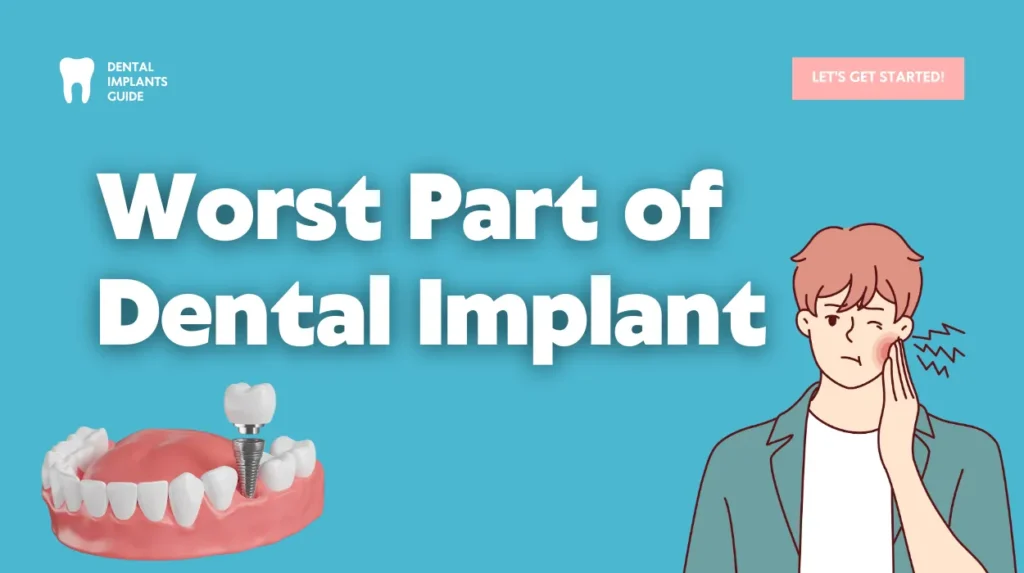 Worst Part of Dental Implant